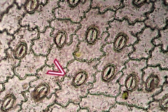 stomacomplex-5